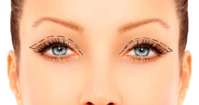 Cuidados com a pele dos olhos pós-blefaroplastia