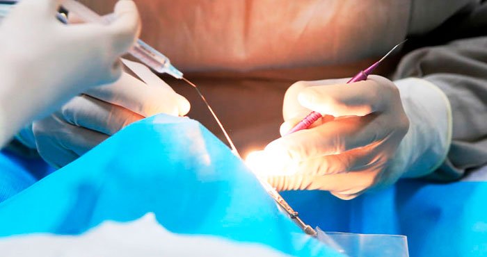 Entenda como funciona a cirurgia Retinopexia com Introflexão Escleral