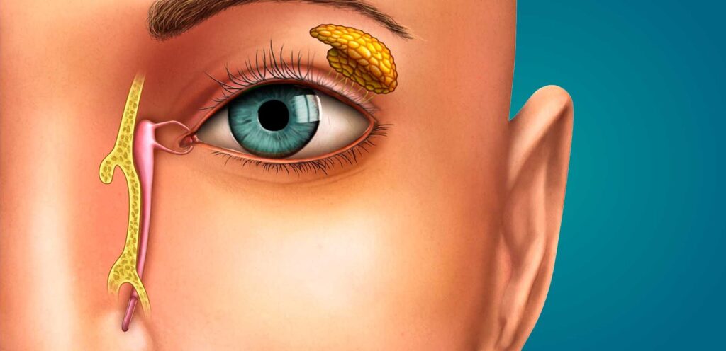Como é feita a cirurgia de via lacrimal