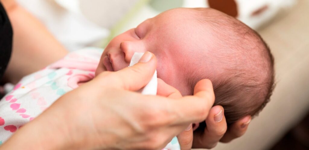 Conjuntivite Neonatal - Como tratar