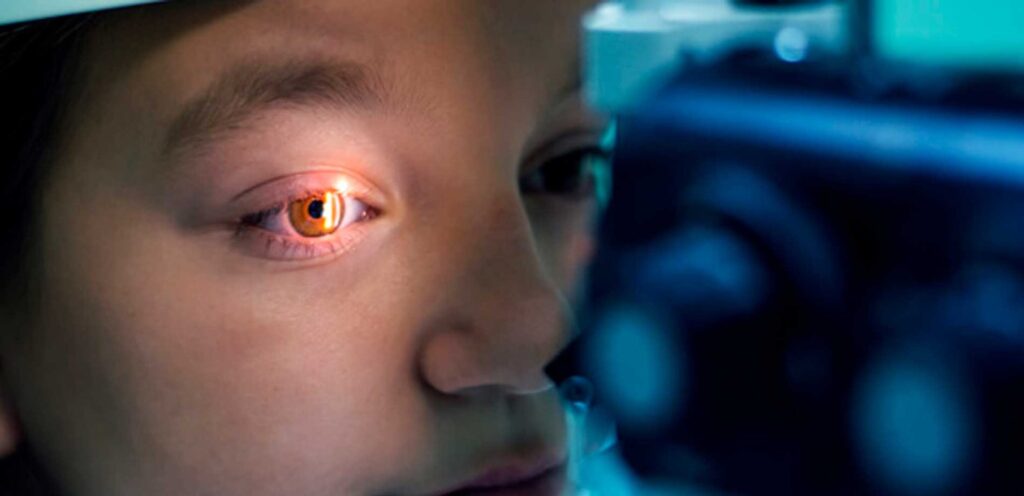 Glaucoma: o que é, sintomas, causas, e tratamento