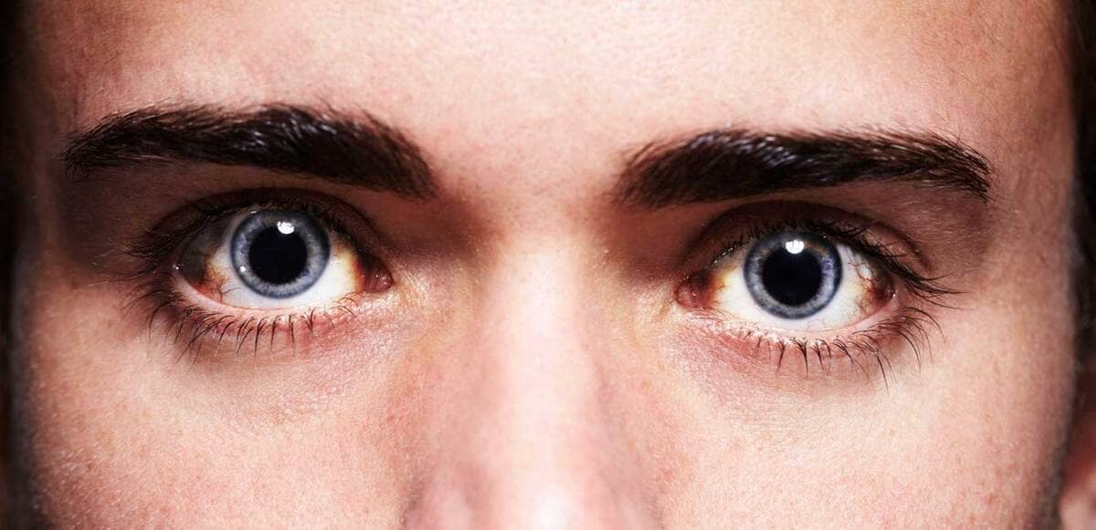 O que fazer quando nossas pupilas se dilatam sozinhas?
