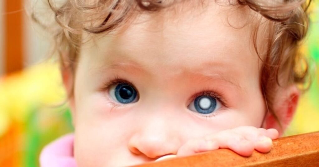 18/9 – Dia Nacional de Conscientização e Incentivo ao Diagnóstico Precoce do Retinoblastoma