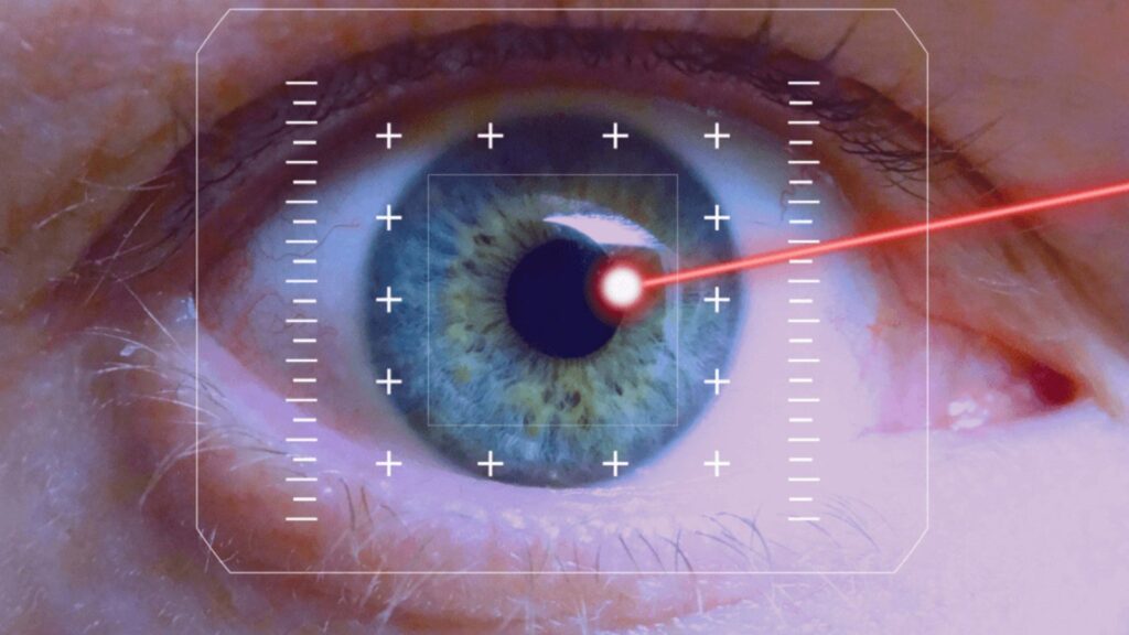 Para que serve a Fotocoagulação a laser?