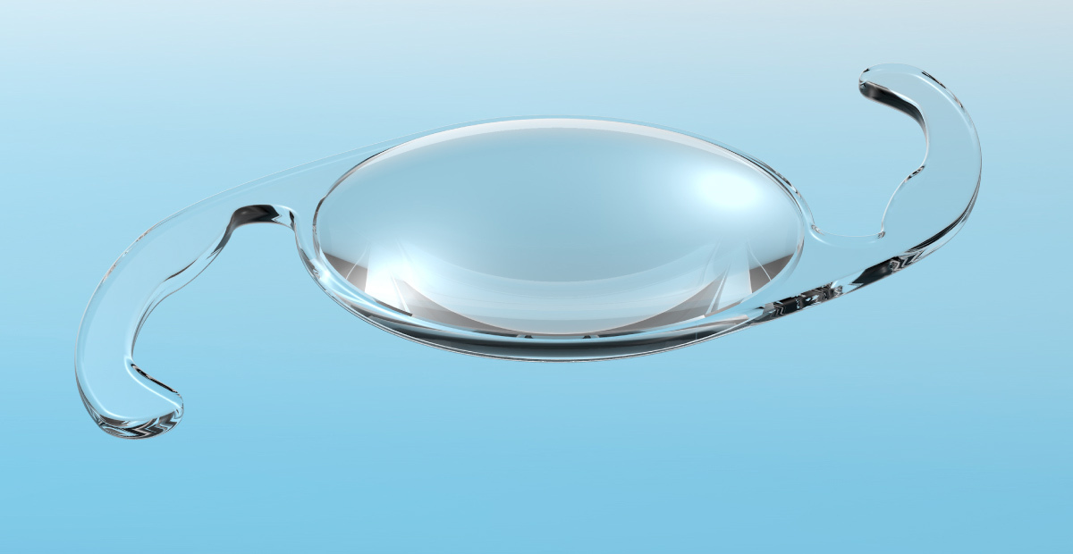 Tipos de lentes intraoculares para cirurgia de catarata
